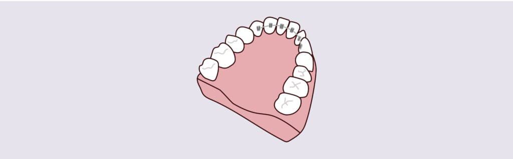 The Hills Dental Associates -