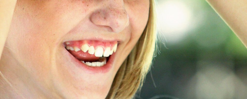 The Hills Dental Associates -