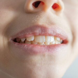 The Hills Dental Associates -
