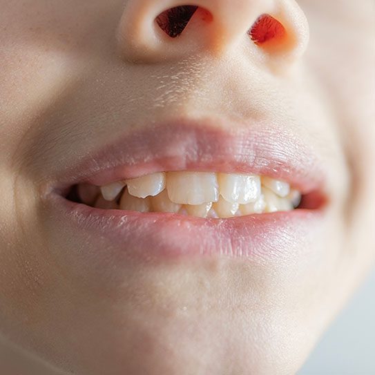 The Hills Dental Associates -