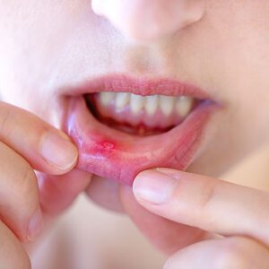 The Hills Dental Associates -
